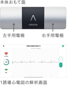 製品おもて面　1誘導心電図の解析画面イメージ