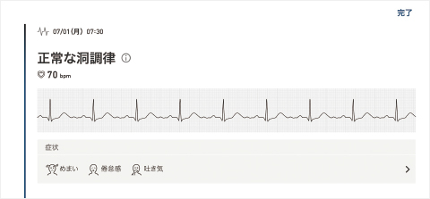 正常な洞調律 画面イメージ