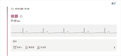 徐脈 画面イメージ